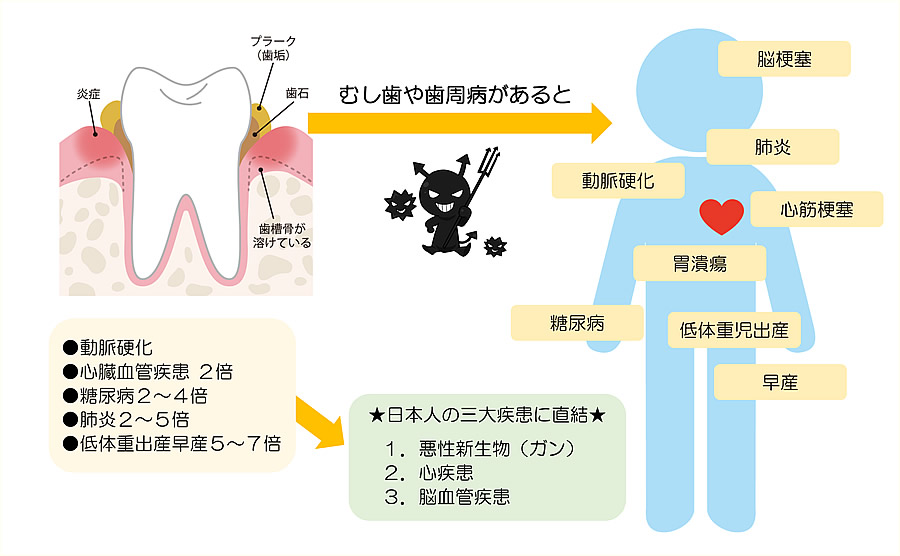 お口の中の健康と全身疾患の関係